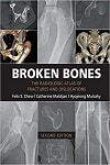 Broken Bone; The X-Ray Atlas of Fractures