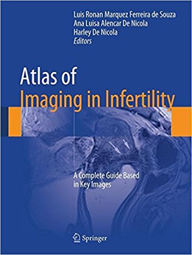 Atlas of Imaging in Infertility; A Complete Guide Based in Key Images - (Luis R. M. F. de Souza)